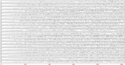 An epilepsy classification based on FFT and fully convolutional neural network nested LSTM